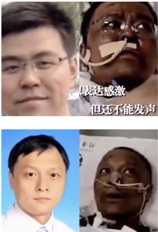 新冠肺炎重症患者皮肤为啥会变黑
